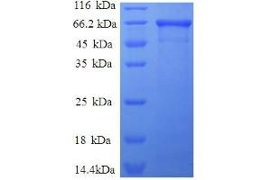 SDS-PAGE (SDS) image for Aldolase A, Fructose-Bisphosphate (ALDOA) (AA 2-364), (full length) protein (GST tag) (ABIN7479578)