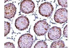 IHC analysis of Symplekin/SYMPK using anti-Symplekin/SYMPK antibody (ABIN7601558). (Symplekin antibody  (AA 384-1092))