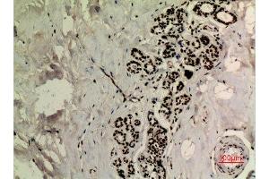 Immunohistochemistry (IHC) analysis of paraffin-embedded Human Breast, antibody was diluted at 1:100.