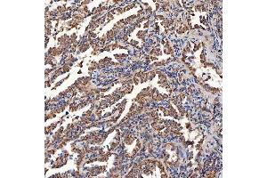 IHC analysis of SCO1 using anti-SCO1 antibody (ABIN7600609). (SCO1 antibody  (AA 21-301))