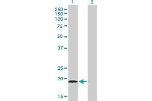Western Blot analysis of TPPP3 expression in transfected 293T cell line by TPPP3 MaxPab polyclonal antibody. (TPPP3 antibody  (AA 1-176))