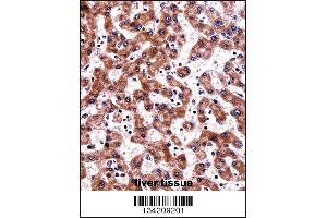 Immunohistochemistry (IHC) image for anti-TNF Receptor-Associated Protein 1 (TRAP1) (AA 542-570), (C-Term) antibody (ABIN5536291)