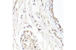 Immunohistochemistry of paraffin-embedded human breast using CDK7 antibody. (CDK7 antibody  (AA 211-346))