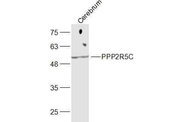 PPP2R5C antibody  (AA 390-435)