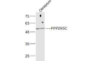 Mouse cerebrum lysates probed with PPP2R5C Polyclonal Antibody, Unconjugated  at 1:300 dilution and 4˚C overnight incubation. (PPP2R5C antibody  (AA 390-435))