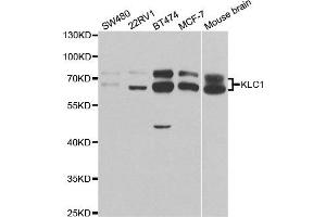 Western Blotting (WB) image for anti-Kinesin Light Chain 1 (KLC1) antibody (ABIN1876732) (KLC1 antibody)