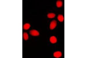 Immunofluorescent analysis of Lamin A/C (pS392) staining in SHSY5Y cells. (Lamin A/C antibody  (pSer392))
