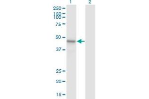 Western Blot analysis of ARMCX1 expression in transfected 293T cell line by ARMCX1 monoclonal antibody (M01), clone 6E10. (ARMCX1 antibody  (AA 188-295))