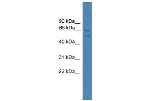 SPATA2 antibody used at 0. (SPATA2 antibody  (C-Term))