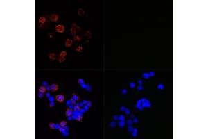 Immunofluorescence analysis of 293T-N and 293T cells using SARS-CoV-2 Nucleoprotein Rabbit mAb (ABIN7269052) at dilution of 1:100,1:400,1:1600,1:3200 (40x lens). (SARS-CoV-2 Spike S2 antibody)