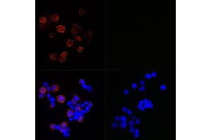 Immunofluorescence analysis of 293T-N and 293T cells using SARS-CoV-2 Nucleoprotein Rabbit mAb (ABIN7269052) at dilution of 1:100,1:400,1:1600,1:3200 (40x lens). (Nucleoprotein antibody)