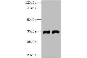 FYTTD1 antibody  (AA 1-318)