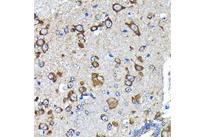Immunohistochemistry of paraffin-embedded mouse spinal cord using Huntingtin Rabbit mAb (ABIN7267793) at dilution of 1:100 (40x lens). (Huntingtin antibody)