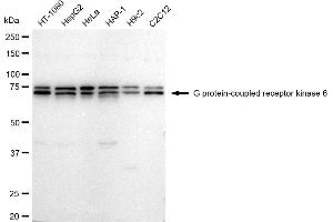 anti-G Protein-Coupled Receptor Kinase 6 (GRK6) antibody