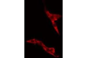 ABIN6275488 staining A549 cells by IF/ICC. (ARHGDIG antibody  (Internal Region))