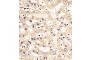 (ABIN659060 and ABIN2838063) staining PDK2 in human liver sections by Immunohistochemistry (IHC-P - paraformaldehyde-fixed, paraffin-embedded sections). (PDK2 antibody)