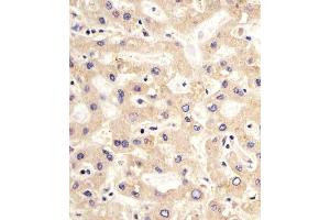 (ABIN659060 and ABIN2838063) staining PDK2 in human liver sections by Immunohistochemistry (IHC-P - paraformaldehyde-fixed, paraffin-embedded sections).