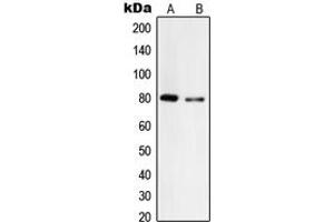 Western blot analysis of Tyrosinase expression in A375 (A), HepG2 (B) whole cell lysates. (TYR antibody  (C-Term))