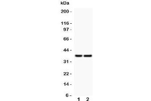 Western blot testing of CD79a antibody and Lane 1:  human placenta;  2: rat spleen; Predicted/Observed molecular weight: 25~47 kDa depending on glycosylation level