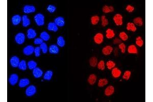 IF analysis of Histone H1. (Histone H1 antibody  (AA 20-159))