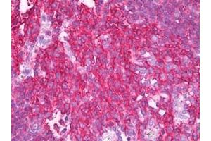 Immunohistochemistry (Paraffin-embedded Sections) (IHC (p)) image for anti-Synaptosomal-Associated Protein, 23kDa (SNAP23) antibody (ABIN1109084)