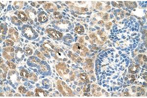 Human kidney (SLC22A16 antibody  (N-Term))