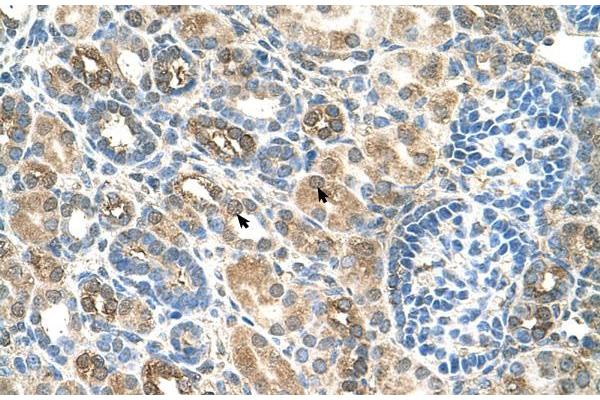 SLC22A16 antibody  (N-Term)