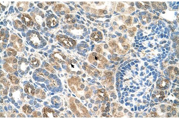 SLC22A16 antibody  (N-Term)