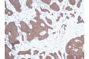 Image no. 3 for anti-Chemokine (C-X-C Motif) Ligand 10 (CXCL10) antibody (ABIN465012) (CXCL10 antibody)