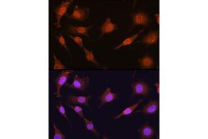 Immunofluorescence (IF) image for anti-Protein Arginine Methyltransferase 5 (PRMT5) (AA 40-140) antibody (ABIN3022066)