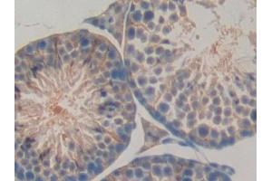 Detection of LBP in Mouse Testis Tissue using Polyclonal Antibody to Lipopolysaccharide Binding Protein (LBP) (LBP antibody  (AA 25-481))