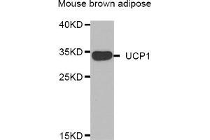 Western blot analysis of extracts of mouse brown adipose, using UCP1 antibody (ABIN5974361).