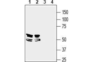 Western blot analysis of mouse brain (lanes 1 and 3) and rat hippocampus (lanes 2 and 4) lysates: - 1,2. (LRRTM1 antibody  (Extracellular, N-Term))