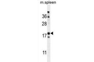 Western Blotting (WB) image for anti-Retinol Binding Protein 7, Cellular (RBP7) antibody (ABIN2999706)