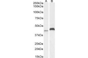 (ABIN184935) (2 μg/mL) staining of A431 (A) and HeLa (B) cell lysate (35 μg protein in RIPA buffer). (RNF13 antibody  (C-Term))