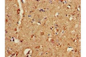 Immunohistochemistry (IHC) image for anti-Purinergic Receptor P2X, Ligand Gated Ion Channel 1 (P2RX1) (AA 54-175) antibody (ABIN7162439)