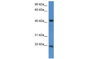 WB Suggested Anti-IMMP2L Antibody Titration: 0. (IMMP2L antibody  (C-Term))