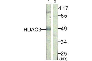 Immunohistochemistry analysis of paraffin-embedded human skin tissue, using HDAC3 (Ab-424) antibody. (HDAC3 antibody)