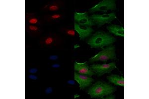 ABIN6261587 and ABIN6266534 staining  cells by IF/ICC.