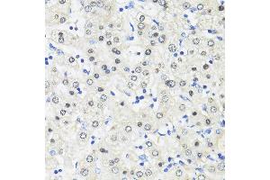 Immunohistochemistry of paraffin-embedded Human liver using TRIM27 antibody (ABIN7269922) at dilution of 1:100 (40x lens).
