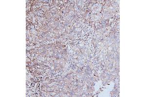 IHC analysis of DDR1 using anti-DDR1 antibody (ABIN7601407). (DDR1 antibody  (AA 341-909))