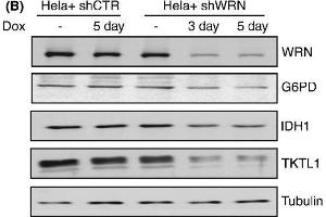 Werner syndrome protein (WRN) depletion alters the levels of metabolic enzymes. (Glucose-6-Phosphate Dehydrogenase antibody)