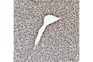 anti-Fumarylacetoacetate Hydrolase (Fumarylacetoacetase) (FAH) (AA 1-342) antibody