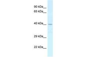 Image no. 1 for anti-Cathepsin E (CTSE) (AA 183-232) antibody (ABIN6747440) (Cathepsin E antibody  (AA 183-232))