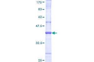 HACE1 Protein (AA 800-909) (GST tag)