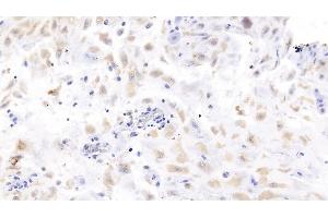 Detection of LHb in Human Placenta Tissue using Monoclonal Antibody to Luteinizing Hormone Beta Polypeptide (LHb) (LHB antibody  (AA 21-141))