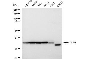 Western blotting analysis using TSFM antibody (ABIN7800656). (Recombinant TSFM antibody)