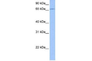 WB Suggested Anti-ZNF317 Antibody Titration:  0. (ZNF317 antibody  (C-Term))