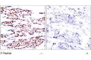 Image no. 1 for anti-Jun B Proto-Oncogene (JUNB) (pSer79) antibody (ABIN196656) (JunB antibody  (pSer79))