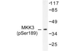 Image no. 1 for anti-Mitogen-Activated Protein Kinase Kinase 3 (MAP2K3) (pSer189) antibody (ABIN318070) (MAP2K3 antibody  (pSer189))